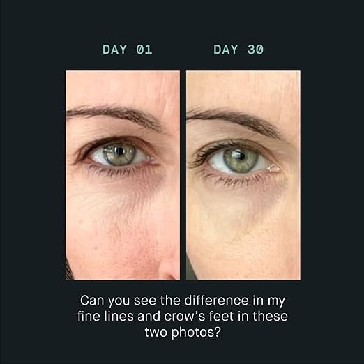 OS-01 EYE Topical Supplement - 20 ml