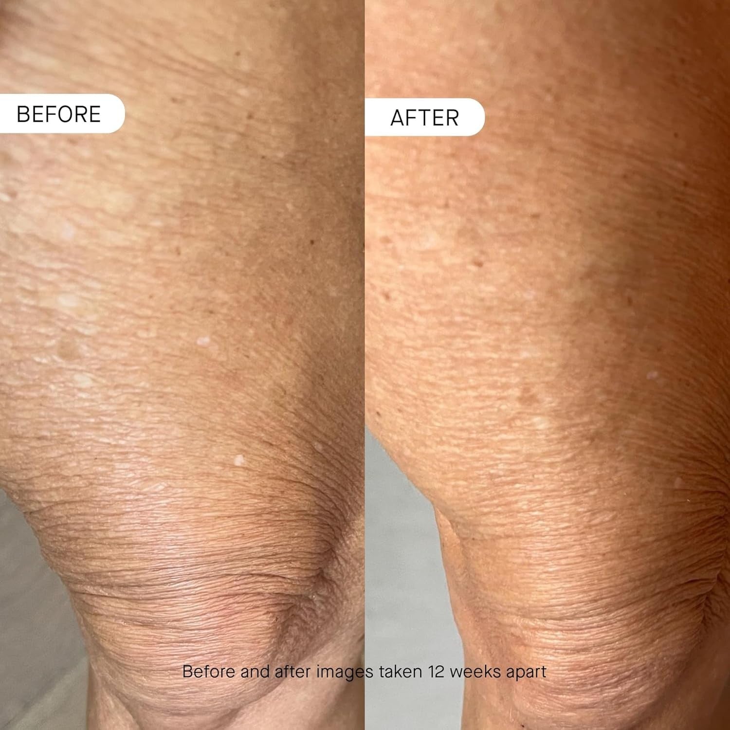 OS-01 BODY Topical Supplement - 250 ml