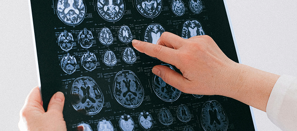 Brain health / Health diagnostics