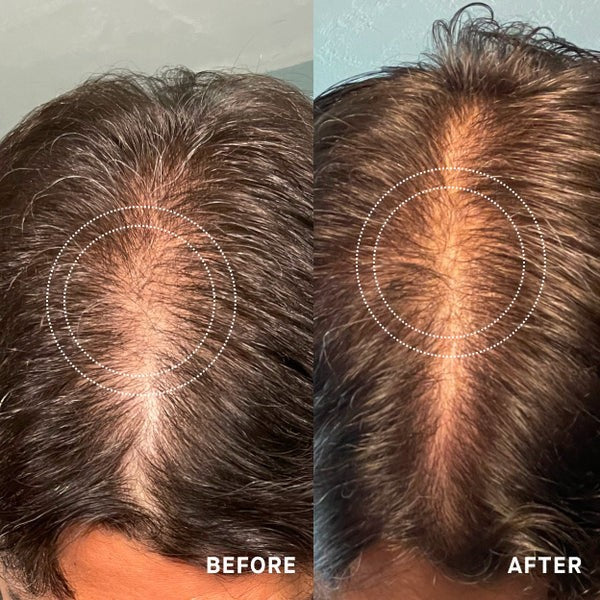 OS-01 HAIR Peptide Scalp Serum - 50 ml