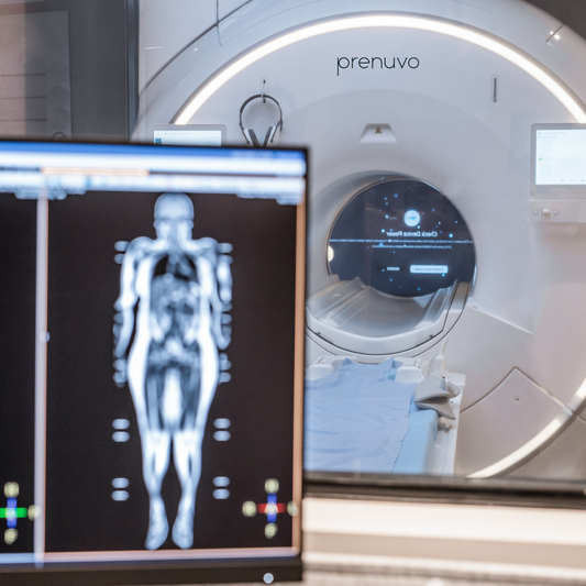 Prenuvo Full Body MRI- PRIORITY ACCESS-