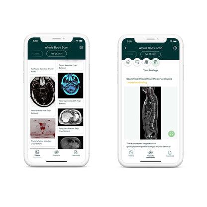 Prenuvo Full Body MRI- PRIORITY ACCESS-